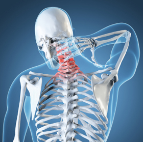 How to relieve neck pain, Richmond, VA